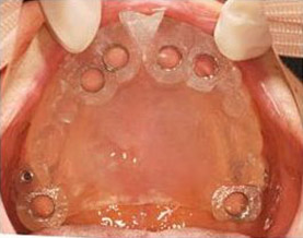 ガイデットサージェリーシステム